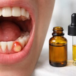 découvrez si le cbd peut aider à faire disparaître un abcès dentaire, ses effets potentiels et les précautions à prendre pour soulager la douleur naturellement.